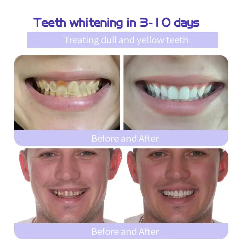 Teeth Restoration Mineral Powder - Image 6