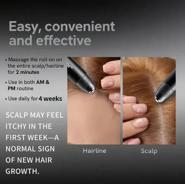 Professional Anti-Hair Loss Roll-On – Stimulates Hair Growth in 1–2 Weeks - Image 2