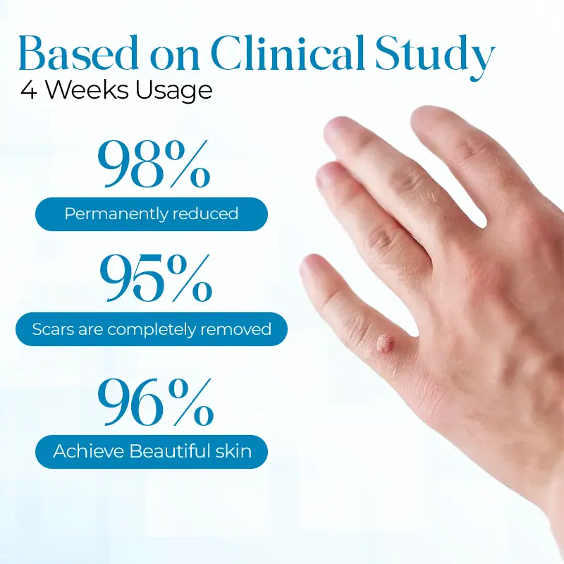 PapiClear Skin Tag & Wart Cream - Image 3