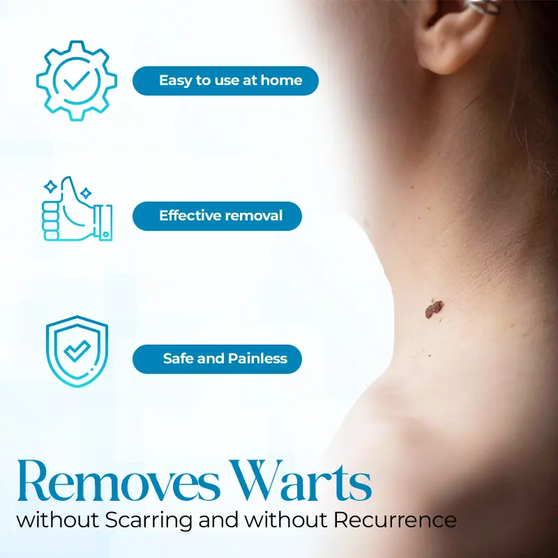 PapiClear Skin Tag & Wart Cream - Image 5