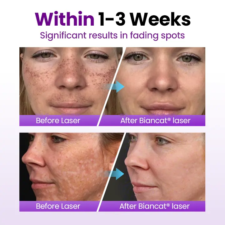 SpotErase Probiotic Shield Serum - Image 3