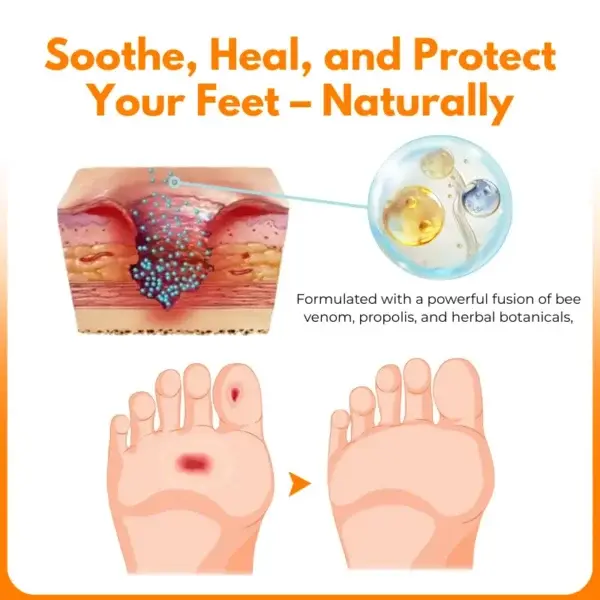 VenHeal Bee Venom Diabetic Wound Spray - Image 5