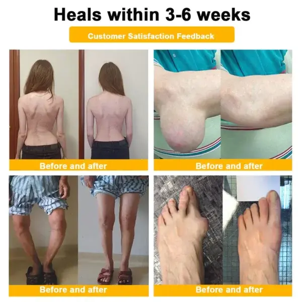 Botulinum Toxin & Bee Venom Orthopedic Relief Cream - Image 13