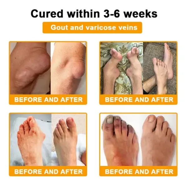 Botulinum Toxin & Bee Venom Orthopedic Relief Cream - Image 8