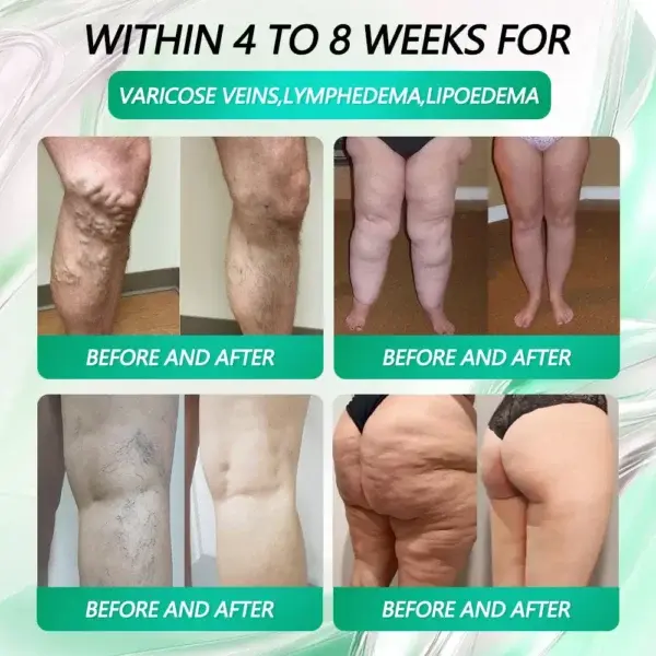 AMPK Metabolic Activating Patches - Image 3