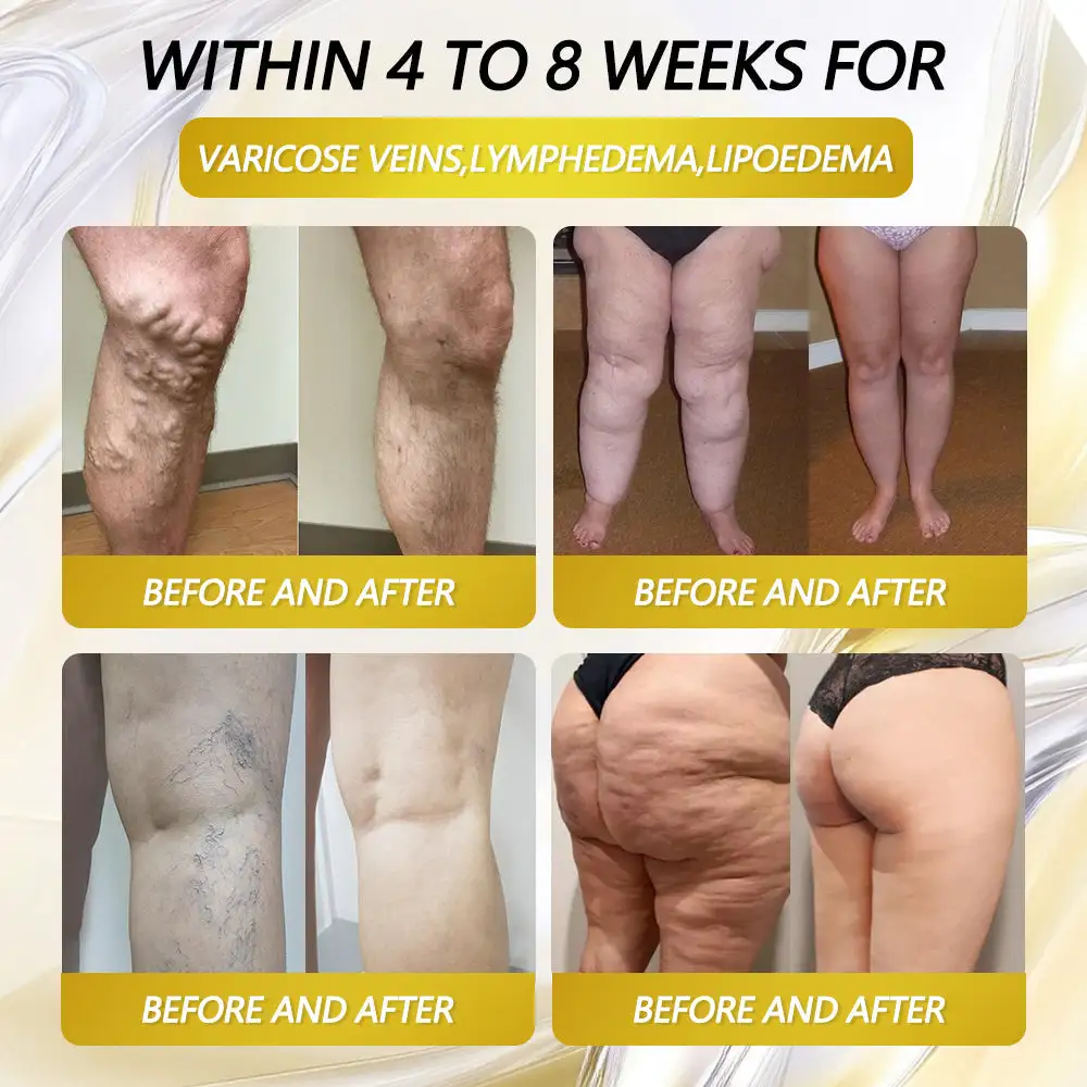 AMPK Metabolism Activating Patches - Image 5