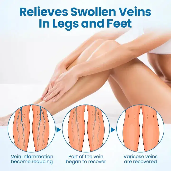 VenoEase Herbal Spray - Image 7