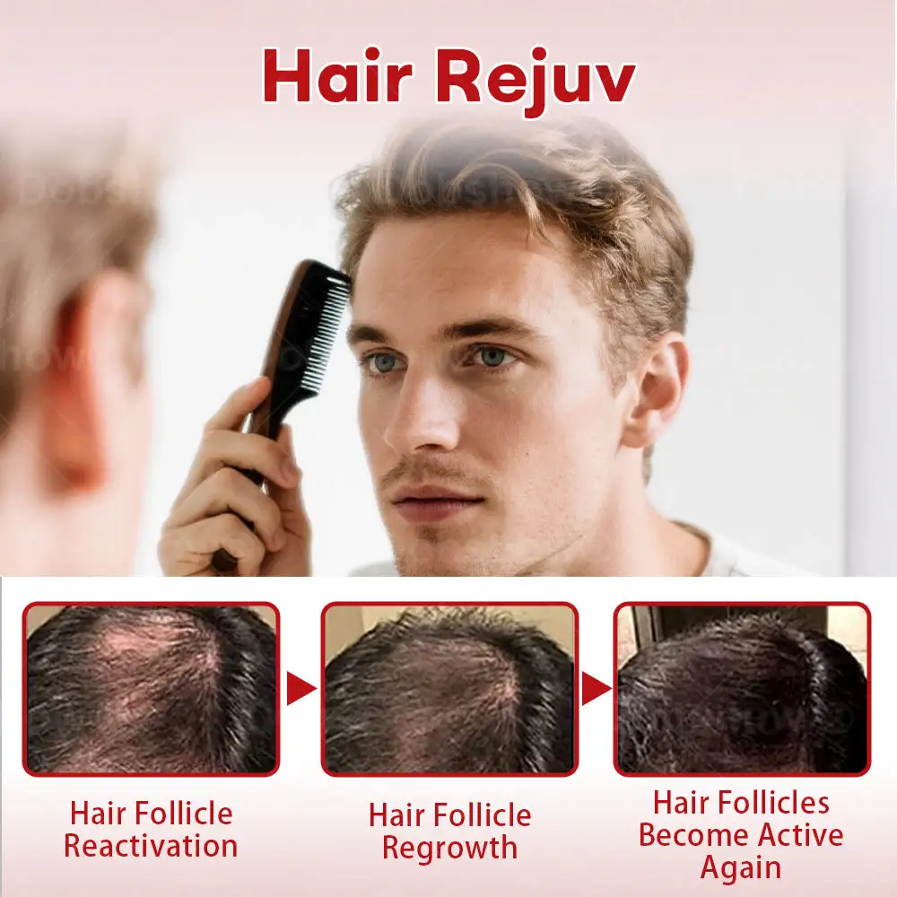 Hair Regrowth System - Image 2