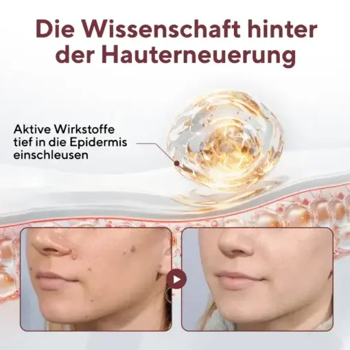 KeraErase Dual-Action Erneuerungscreme - Image 4