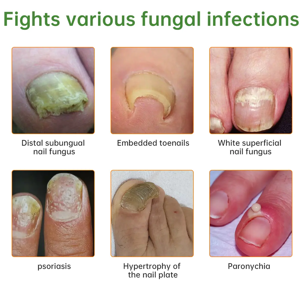 Bee Venom Nail Fungus Treatment Liquid - Image 2