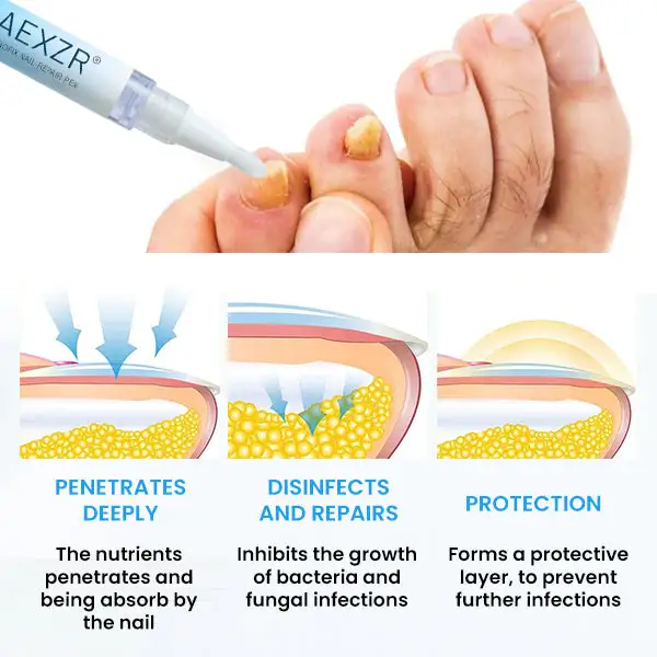 NanoFix Nail Repair Pen - Image 5