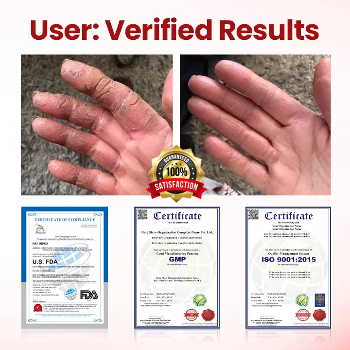 FootGuard Diabetic Care Cream - Image 3