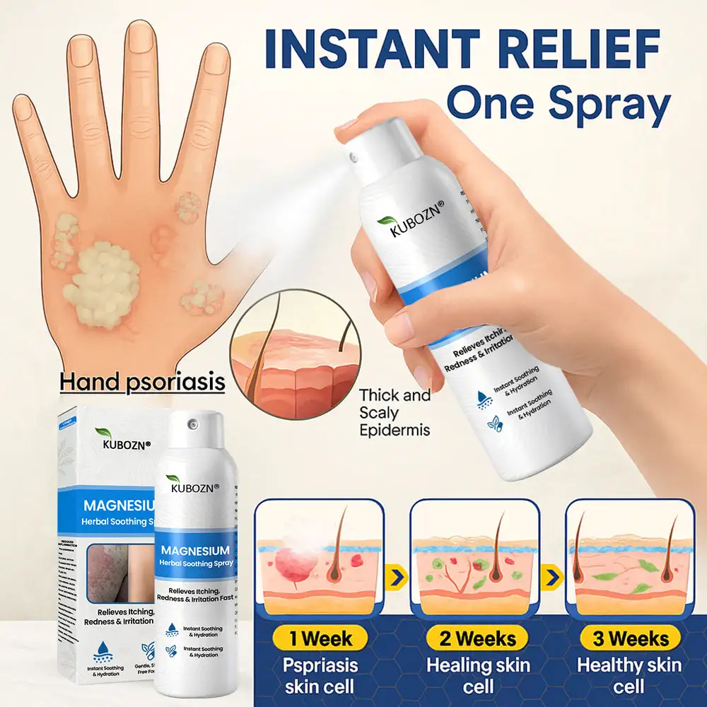 Magnesium Herbal Psoriasis Spray - Image 4