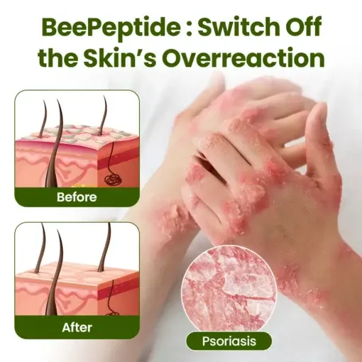 BeePeptide RootSoft DualRelief Cream - Image 2