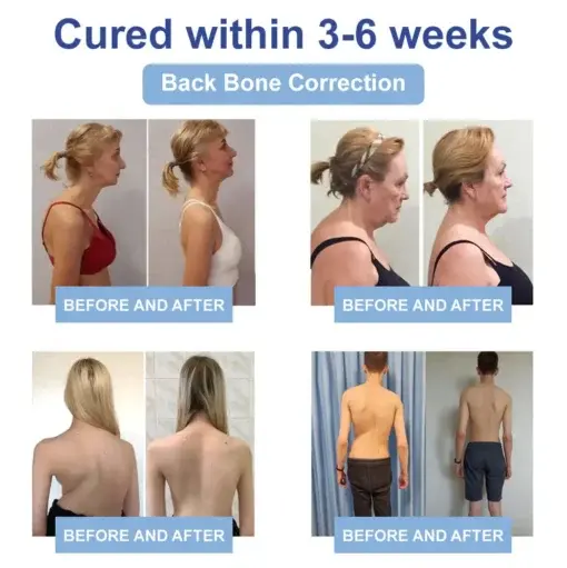 Black Rice Pain Healing Bone Cream - Image 13