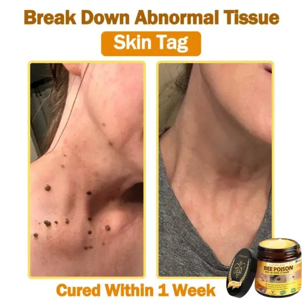 𝐁𝐞𝐞 Poison 𝐀𝐥𝐥-𝐢𝐧-𝐎𝐧𝐞 𝐂𝐫𝐞𝐚𝐦 - Image 6