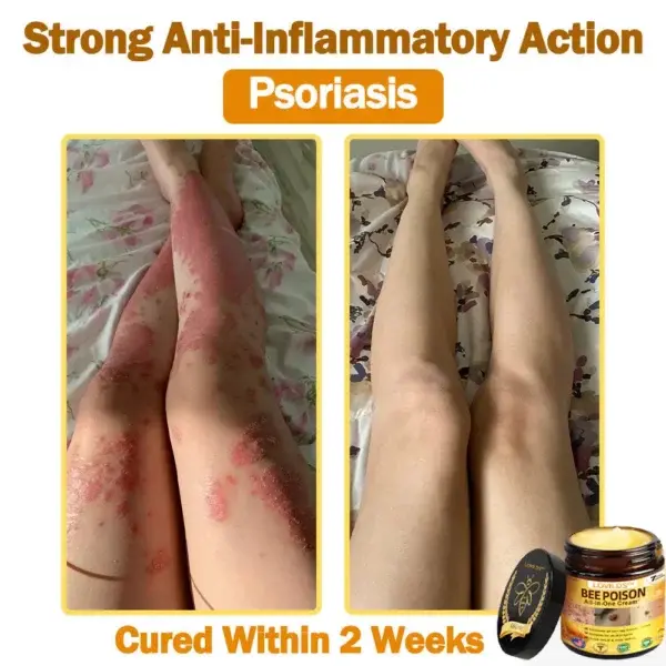 𝐁𝐞𝐞 Poison 𝐀𝐥𝐥-𝐢𝐧-𝐎𝐧𝐞 𝐂𝐫𝐞𝐚𝐦 - Image 9