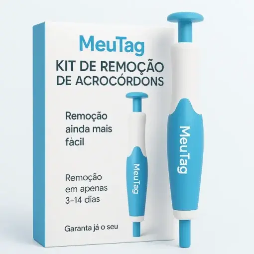 Skin Wart & Skin Tag Removal Kit - Image 5