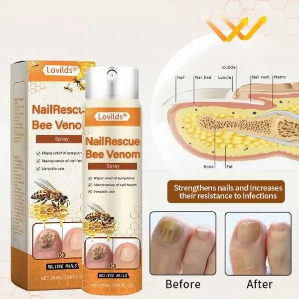 NailRescue Bee Wenom - Image 5