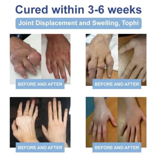 Magnesium Pain Relief & Bone Healing Cream - Image 4