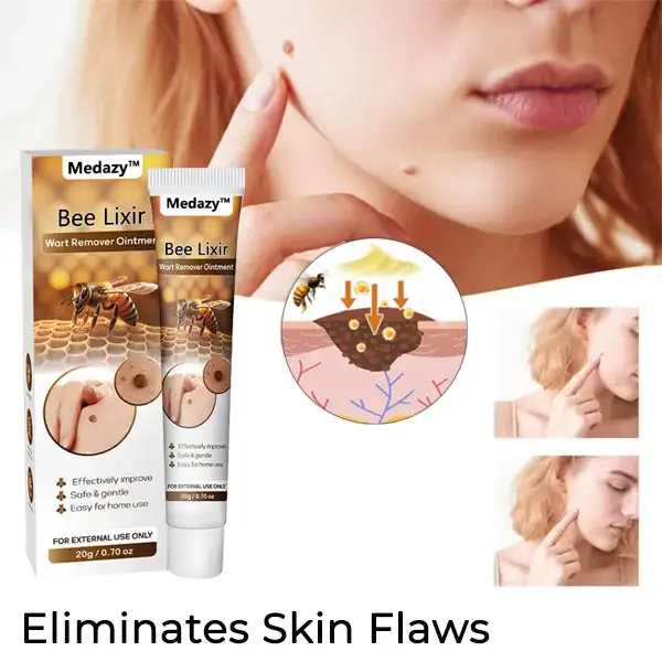 Bee Lixir Wart Remover Ointment - Image 3