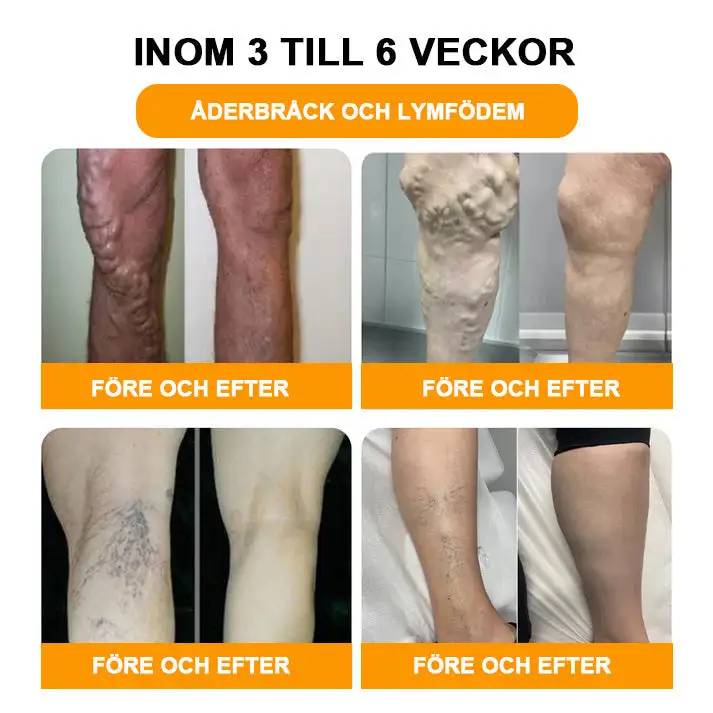 Lymphatic Drainage Foot Bath for Weight Loss - Image 4