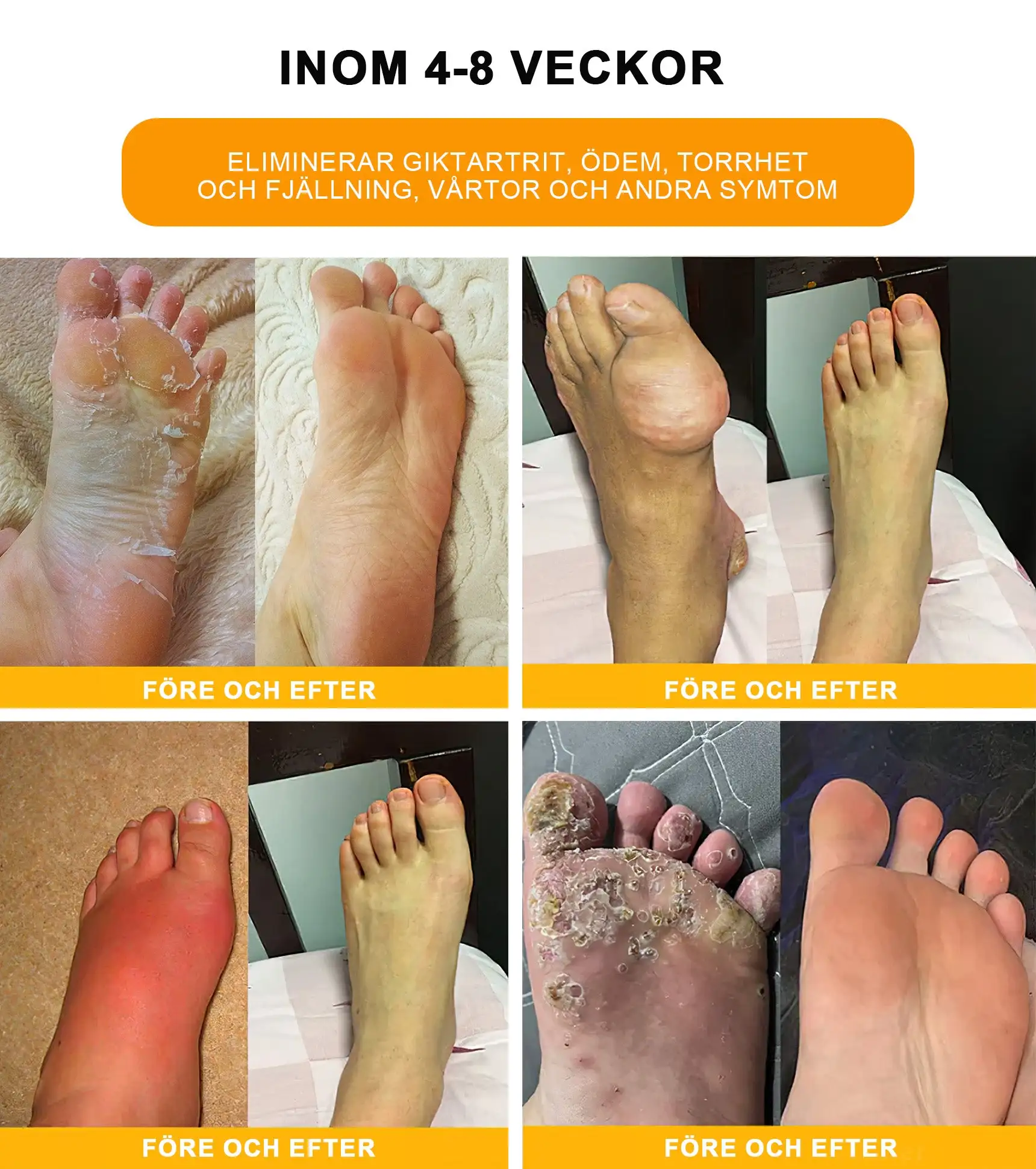 Lymphatic Drainage Foot Bath for Weight Loss - Image 5