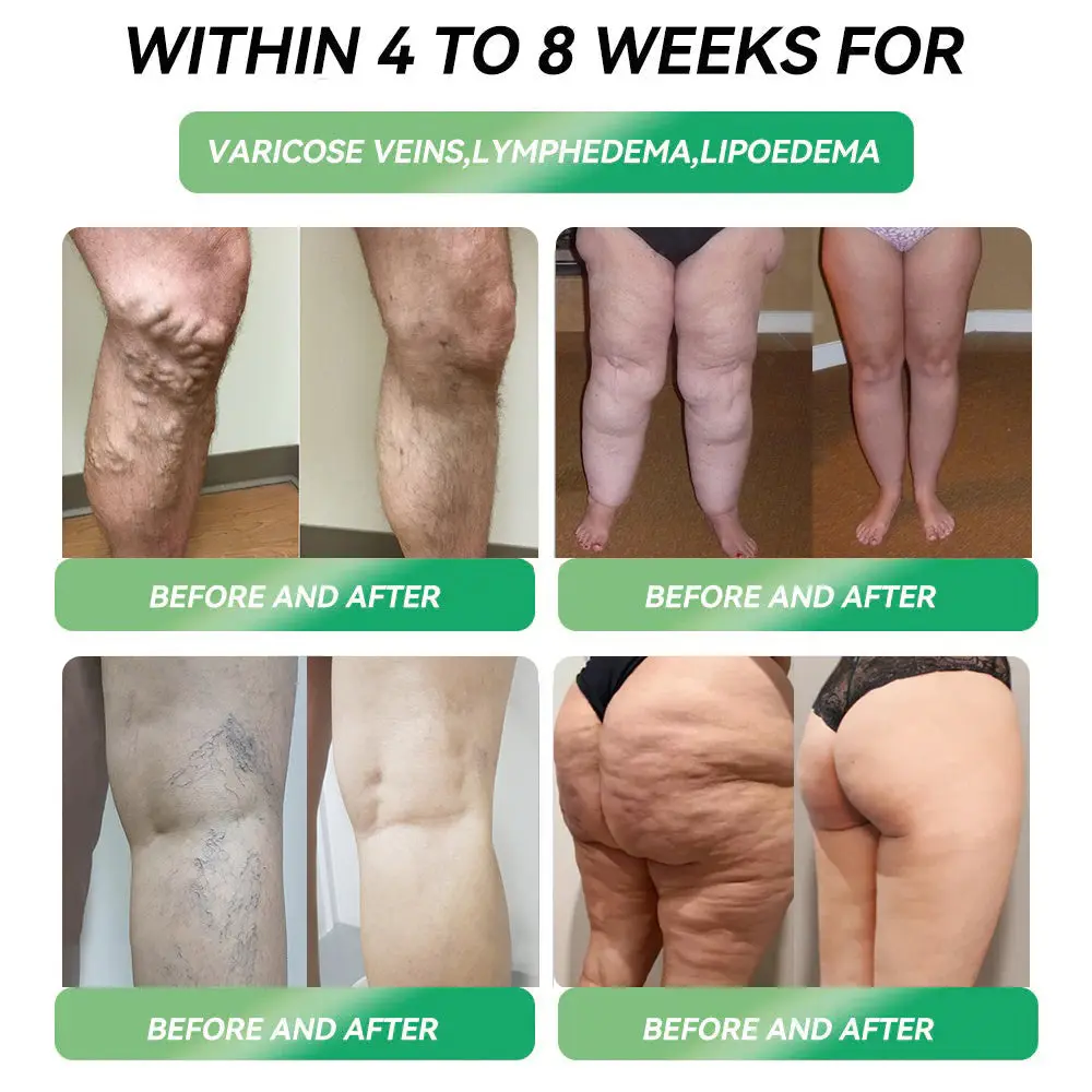 Telportide Oral Solution - Image 4