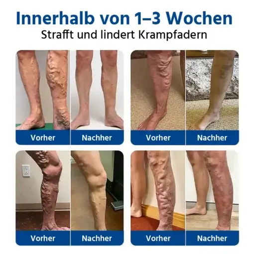 ๐๐๐ข๐ง๐๐๐ซ๐ ๐๐ญ ๐๐ข๐๐ซ๐จ๐ง๐๐๐๐ฅ๐ ๐๐๐ญ๐๐ก - Image 2