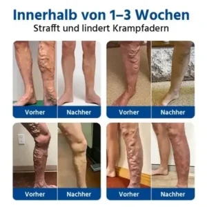 Alternative view of 𝐕𝐞𝐢𝐧𝐓𝐚𝐫𝐠𝐞𝐭 𝐌𝐢𝐜𝐫𝐨𝐧𝐞𝐞𝐝𝐥𝐞 𝐏𝐚𝐭𝐜𝐡