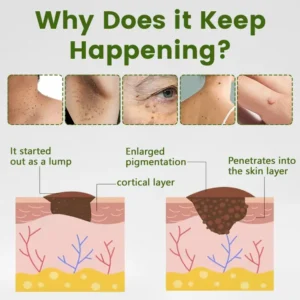 Alternative view of ThujaClear Botanical Wart Cream