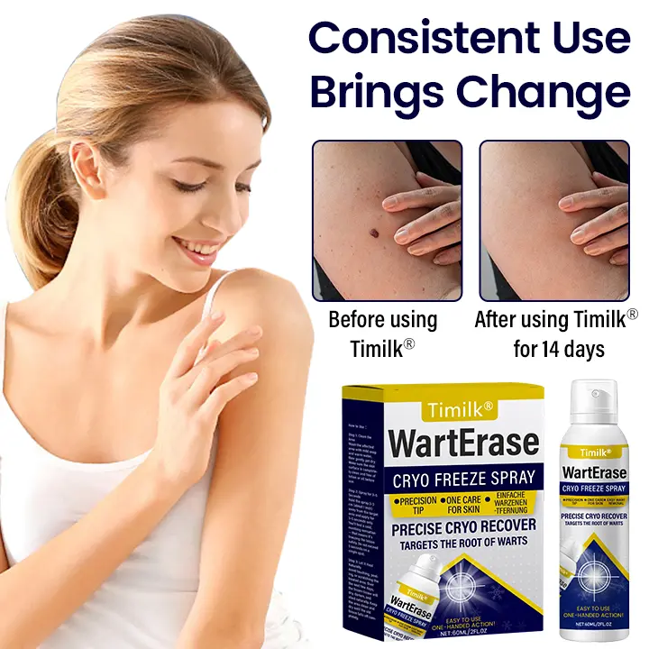 WartErase Cryo Freeze Spray - Image 6