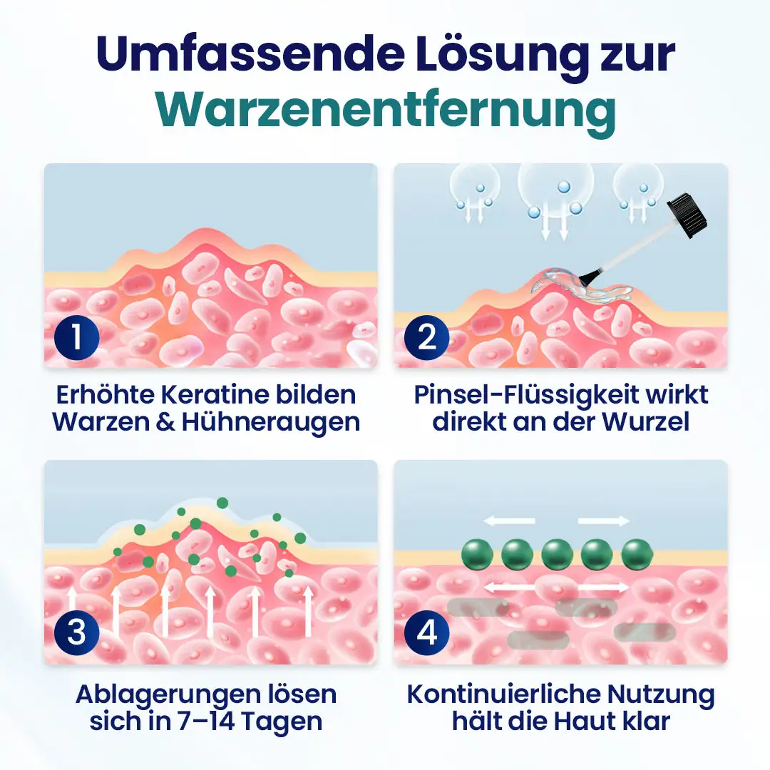 WartLift Warzen-Entfernungsflüssigkeit - Image 4