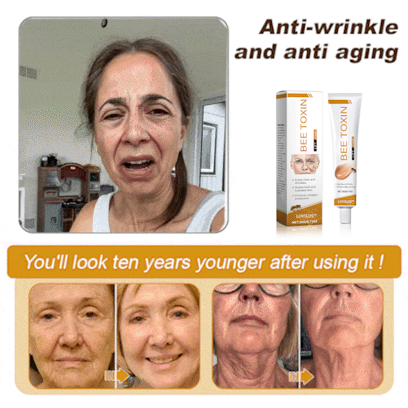 Winter Sale Bee Toxin Wrinkle Removal Cream - Image 10