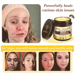 Alternative view of Winter Sale Bee Venom Skin Restoration Cream