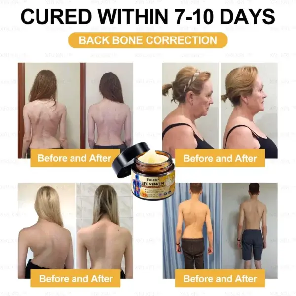 Bee Venom Arthritis Therapy Cream - Image 3