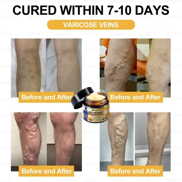 Bee Venom Arthritis Therapy Cream - Image 6