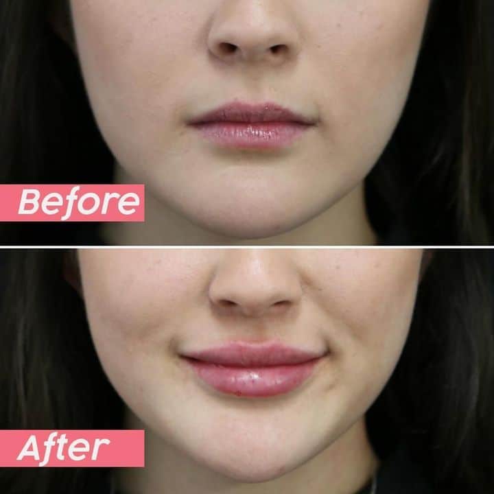 JUICY LIP PLUMPING GLOSS - Image 5