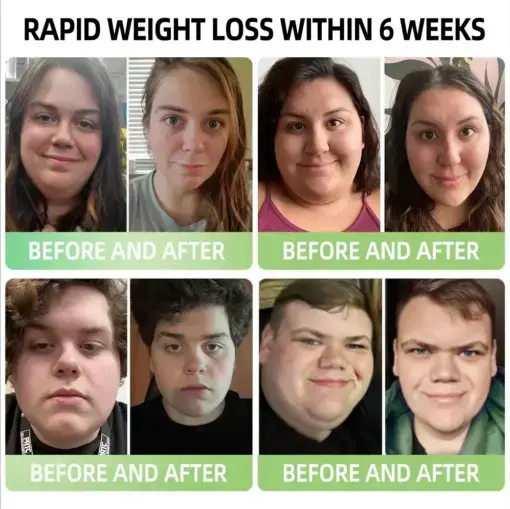 𝑵𝒂𝒏𝒐 𝑴𝒊𝒄𝒓𝒐𝒏𝒆𝒆𝒅𝒍𝒆 𝑷𝒂𝒕𝒄𝒉 - Image 6