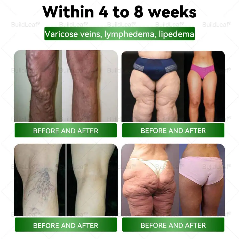 Herbal Oral Liquid - Image 4