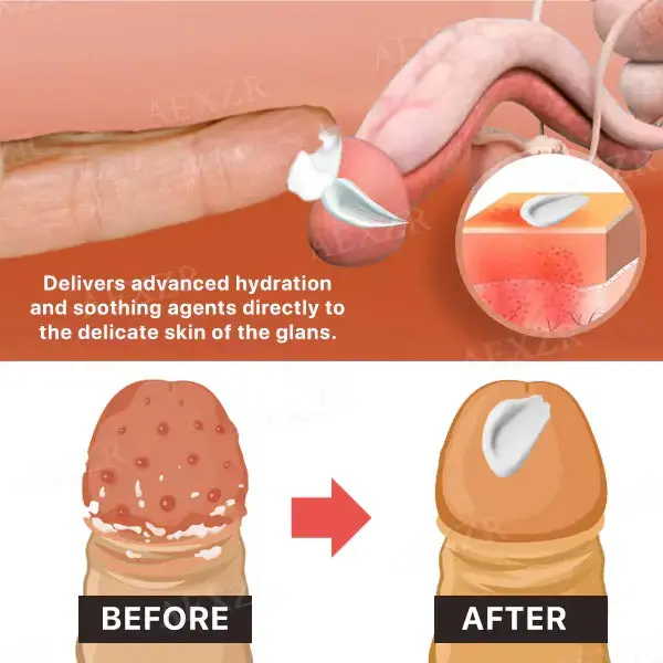 Glans Care Cream - Image 3