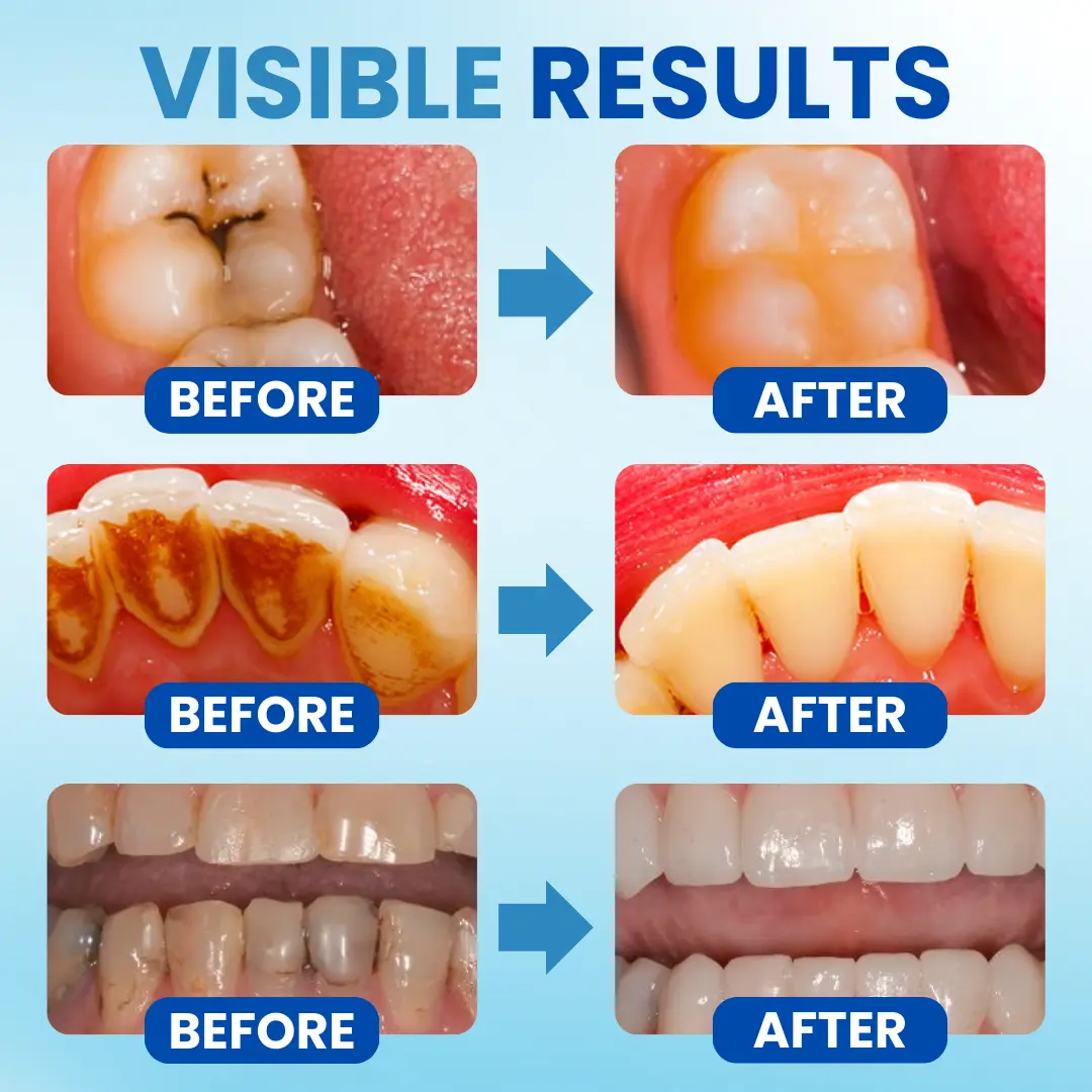 Postbiotics Anti-Plaque Oral Serum - Image 6