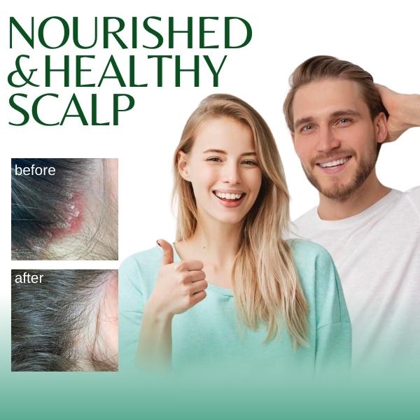 Seborrheic Dermatitis Spray - Image 3