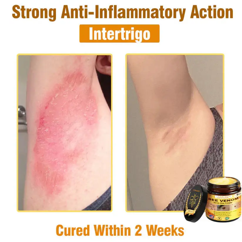 πππ πππ§π¨π¦ ππ₯π₯-π’π§-ππ§π ππ«πππ¦βAnti-Aging, Hydrating & Skin Repair - Image 12