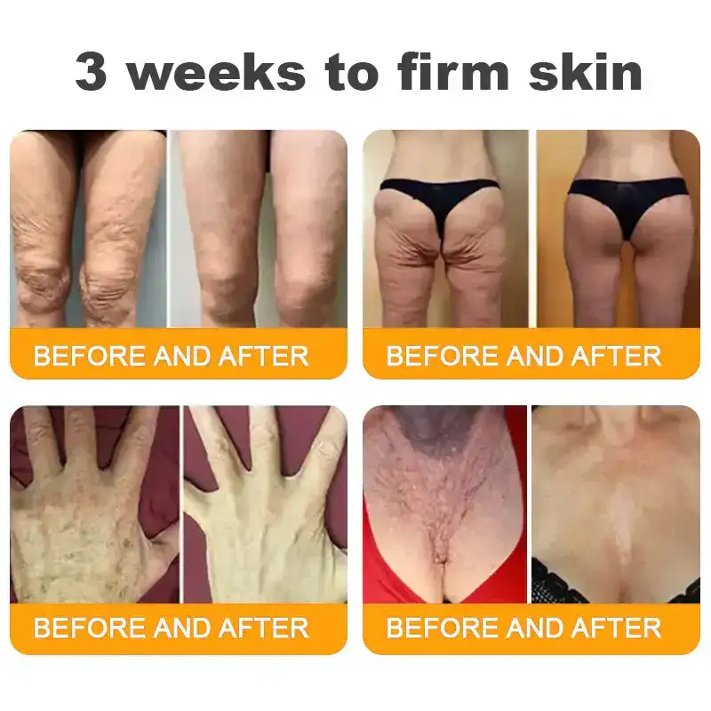 πππ πππ§π¨π¦ ππ₯π₯-π’π§-ππ§π ππ«πππ¦βAnti-Aging, Hydrating & Skin Repair - Image 7