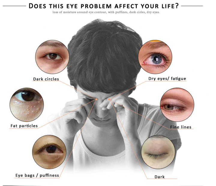 Anti-Wrinkle Eye Serum - Image 5