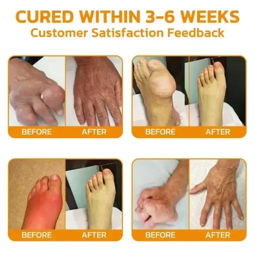 Bee Venom Pain Suppression Joint Healing Cream - Image 4