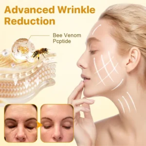 Alternative view of 𝐁𝐨𝐭𝐨𝐱𝐋𝐮𝐱 𝐁𝐞𝐞 𝐕𝐞𝐧𝐨𝐦 𝐋𝐢𝐟𝐭 𝐂𝐫𝐞𝐚𝐦