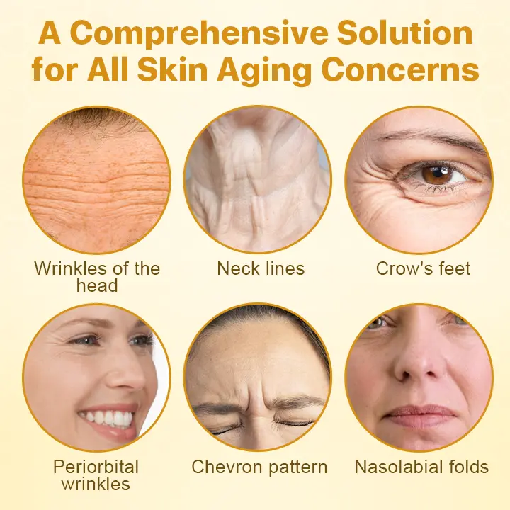 𝐁𝐨𝐭𝐨𝐱𝐋𝐮𝐱 𝐁𝐞𝐞 𝐕𝐞𝐧𝐨𝐦 𝐋𝐢𝐟𝐭 𝐂𝐫𝐞𝐚𝐦 - Image 7