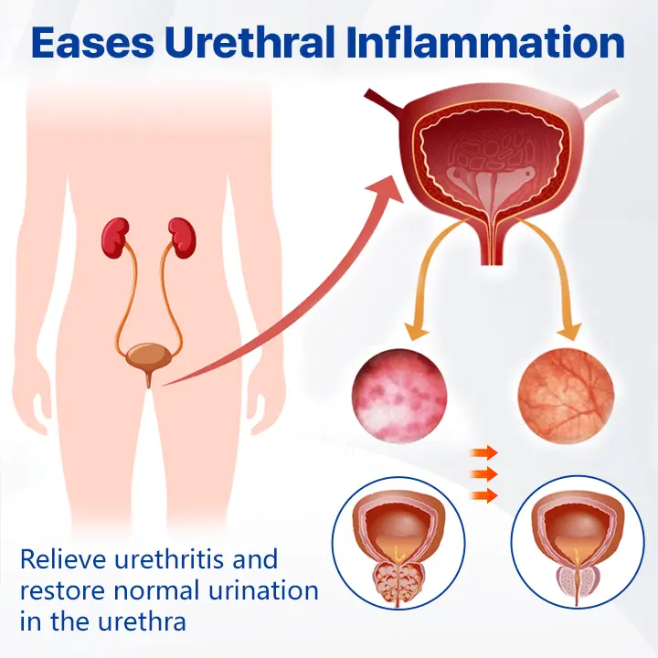 Prostate Magnetic Therapy Bracelet - Image 4